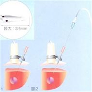 PEIT针八光经皮酒精注射疗法针21G*150mm价格