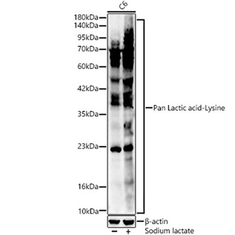 泛乳酸化赖氨酸兔多克隆抗体 / Pan-Kla多抗